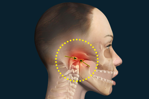 Jaw Deformity Correction Orthognathic